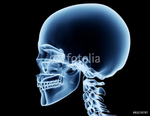x-ray image of a man isolated on black - 901145869