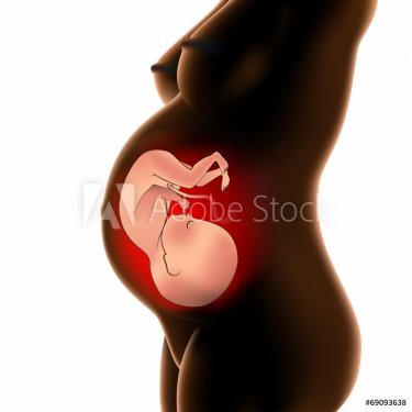 pregnant with fetus - 901145843