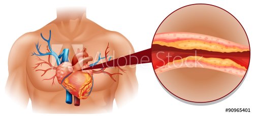 Cholesterol in human heart