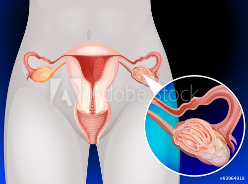 Female genitals of human - 901145819