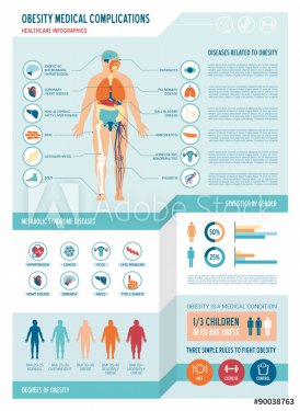 Obesity infographics - 901145751
