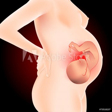 pregnant with fetus - 901145842