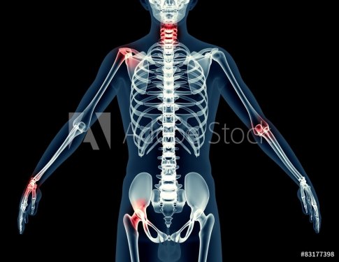 x-ray image of a man isolated on black - 901145870