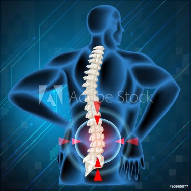 Spine bone showing back pain - 901145818